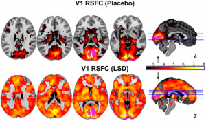 ayahuasca neuroscience